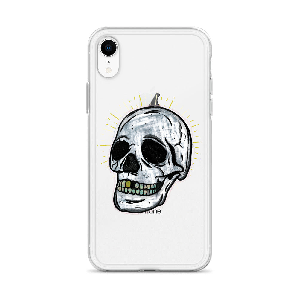 Stay Gold | iPhone Case